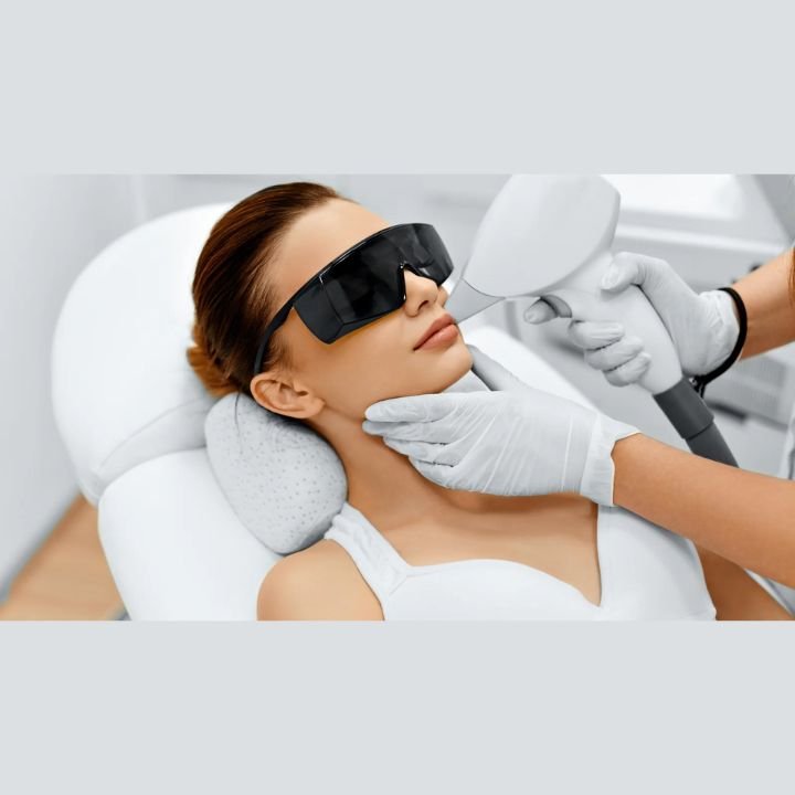 laser hair removal